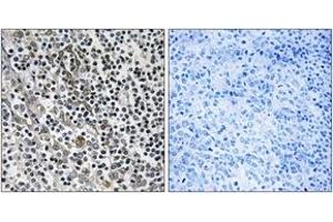 Immunohistochemistry analysis of paraffin-embedded human tonsil tissue, using MRPL51 Antibody.