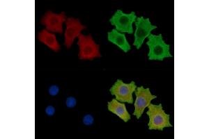ABIN7095688 and ABIN7099750 staining HepG2 cells by IF/ICC. (ASIC3 anticorps)