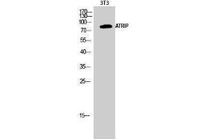 Western Blotting (WB) image for anti-ATR Interacting Protein (ATRIP) (Tyr783) antibody (ABIN3179886) (ATRIP anticorps  (Tyr783))