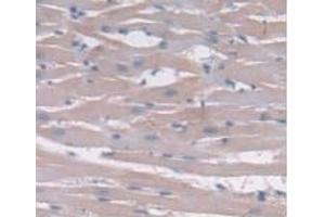 Detection of IL24 in Rat Heart Tissue using Monoclonal Antibody to Interleukin 24 (IL24) (IL-24 anticorps  (AA 29-183))