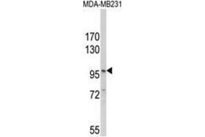 Western blot analysis of NLRP3 Antibody (N-term) in MDA-MB231 cell line lysates (35ug/lane). (NLRP3 anticorps  (N-Term))