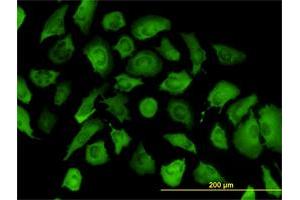 Immunofluorescence of monoclonal antibody to ANXA2 on HeLa cell.