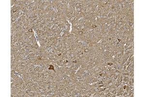 IHC analysis of KCNA1 using anti-KCNA1 antibody (ABIN6719578).