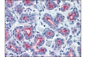 Immunohistochemistry (IHC) image for anti-Mucin 1 (MUC1) (C-Term) antibody (ABIN371859)