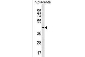 ZN Antibody (C-term) (ABIN1537259 and ABIN2838224) western blot analysis in human placenta tissue lysates (35 μg/lane). (ZNF662 anticorps  (C-Term))