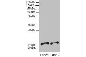 Western blot All lanes: PFDN5 antibody at 2 μg/mL Lane 1: EC109 whole cell lysate Lane 2: 293T whole cell lysate Secondary Goat polyclonal to rabbit IgG at 1/15000 dilution Predicted band size: 18, 8, 13 kDa Observed band size: 18 kDa (PFDN5 anticorps  (AA 2-154))