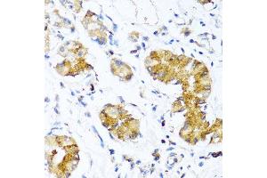 Immunohistochemistry of paraffin-embedded human stomach using WFDC2 antibody at dilution of 1:100 (40x lens). (WFDC2 anticorps)