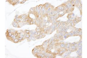 Immunohistochemistry (IHC) image for anti-KIAA1524 (KIAA1524) (AA 550-600) antibody (ABIN7448939) (KIAA1524 anticorps  (AA 550-600))