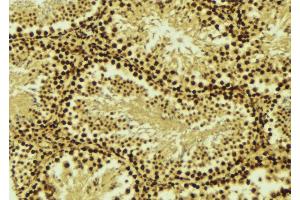 ABIN6276529 at 1/100 staining Mouse testis tissue by IHC-P. (CRADD anticorps  (Internal Region))