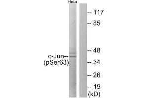 Western Blotting (WB) image for anti-Jun Proto-Oncogene (JUN) (pSer63) antibody (ABIN1847456) (C-JUN anticorps  (pSer63))