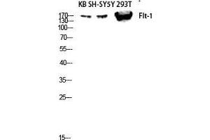 Western Blot (WB) analysis of KB SH-SY5Y 293T lysis using Flt-1 antibody.