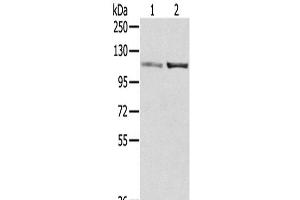 Western Blot analysis of A172 and 231 cells using SENP7 Polyclonal Antibody at dilution of 1/800 (SENP7 anticorps)