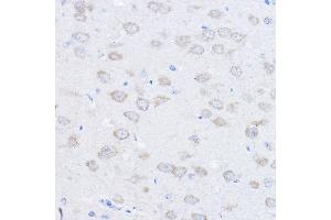 Immunohistochemistry of paraffin-embedded rat brain using UBE4A Rabbit pAb (ABIN6128897, ABIN6149841, ABIN6149842 and ABIN6220229) at dilution of 1:100 (40x lens). (UBE4A anticorps  (AA 797-1066))