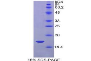 SDS-PAGE analysis of Chicken HIF1a Protein.