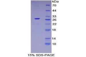 SDS-PAGE (SDS) image for Hepatocyte Nuclear Factor 4, alpha (HNF4A) (AA 131-330) protein (His tag) (ABIN2125183) (HNF4A Protein (AA 131-330) (His tag))