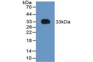 Western blot analysis of recombinant Rat F2. (Prothrombin anticorps  (AA 324-617))