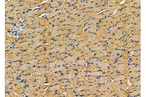 ABIN6260967 and ABIN6279315 at 1/100 staining rat muscle tissue by IHC-P.