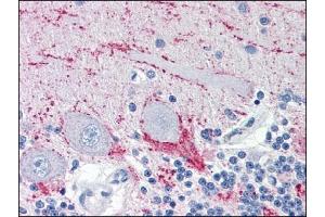 Immunohistochemistry (IHC) image for anti-Vesicle-Associated Membrane Protein 2 (Synaptobrevin 2) (VAMP2) (AA 1-89), (N-Term) antibody (ABIN317061) (VAMP2 anticorps  (N-Term))