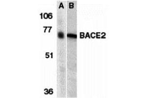 Western Blotting (WB) image for anti-beta-Site APP-Cleaving Enzyme 2 (BACE2) (N-Term) antibody (ABIN1031256) (BACE2 anticorps  (N-Term))