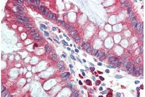 Human Colon (formalin-fixed, paraffin-embedded) stained with HYOU1 antibody ABIN396969 at 5 ug/ml followed by biotinylated goat anti-rabbit IgG secondary antibody ABIN481713, alkaline phosphatase-streptavidin and chromogen. (HYOU1 anticorps  (C-Term))