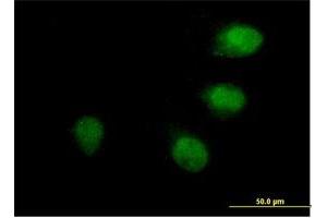 Immunofluorescence of purified MaxPab antibody to ANAPC10 on HeLa cell. (ANAPC10 anticorps  (AA 1-185))