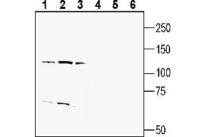 Western blot analysis of human  monocytic leukemia cell line lysate (lanes 1 and 4), human  promyelocytic leukemia cell line lysate (lanes 2 and 5) and human MDA- breast adenocarcinoma cell line lysate (lanes 3 and 6):1-3.