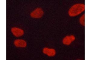 ABIN6267060 staining lovo cells by ICC/IF.