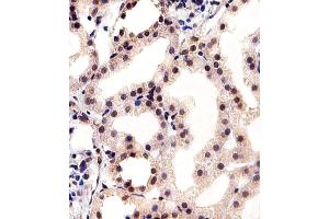 Immunohistochemical analysis of paraffin-embedded H. (CSNK2A1/CK II alpha anticorps  (AA 250-284))