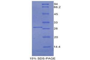 SDS-PAGE (SDS) image for Growth Arrest-Specific 6 (GAS6) (AA 100-312) protein (His tag) (ABIN1525394)