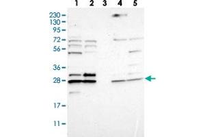 Western blot analysis of Lane 1: RT-4, Lane 2: U-251 MG, Lane 3: Human Plasma, Lane 4: Liver, Lane 5: Tonsil with CNPY4 polyclonal antibody . (CNPY4 anticorps)