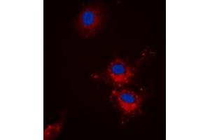 Immunofluorescent analysis of BCLX (pS62) staining in HEK293T cells. (BCL2L1 anticorps  (pSer62))