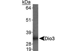 Detection of Dio3 in rat placenta using Dio3 polyclonal antibody . (DIO3 anticorps  (AA 250-300))