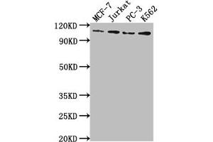 Western Blot Positive WB detected in: MCF-7 whole cell lysate, Jurkat whole cell lysate, PC-3 whole cell lysate, K562 whole cell lysate All lanes: KDM1A antibody at 1:2000 Secondary Goat polyclonal to rabbit IgG at 1/50000 dilution Predicted band size: 93, 96 kDa Observed band size: 110 kDa