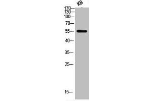 Western Blot analysis of KB using Phospho-Akt (S473) Polyclonal Antibody (AKT 1/2/3 anticorps  (pSer473))