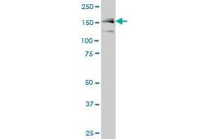 MAP3K5 monoclonal antibody (M03), clone 2D11 Western Blot analysis of MAP3K5 expression in A-431 .