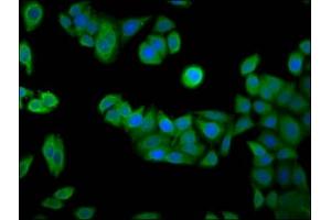Immunofluorescence staining of PC-3 cells with ABIN7167258 at 1:133, counter-stained with DAPI. (RAB24 anticorps  (AA 122-197))