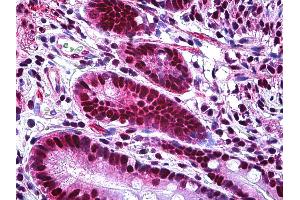 Anti-XRCC6 / Ku70 antibody IHC of human small intestine.