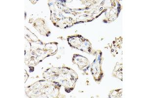 Immunohistochemistry of paraffin-embedded human placenta using KLF5 antibody (ABIN3023447, ABIN3023448, ABIN3023449 and ABIN6219969) at dilution of 1:100 (40x lens). (KLF5 anticorps  (AA 1-250))