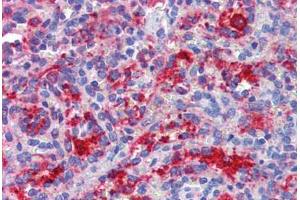 Spleen, Human: Formalin-Fixed, Paraffin-Embedded (FFPE) (DDX58 anticorps)
