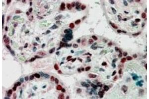 Immunohistochemistry (IHC) image for anti-Chromobox Homolog 1 (CBX1) antibody (ABIN5890958) (CBX1 anticorps)