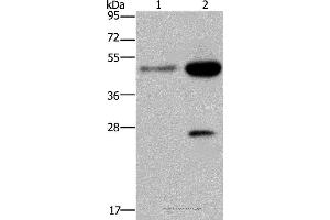 Western blot analysis of 231 and Hela cell, using CD160 Polyclonal Antibody at dilution of 1:300 (CD160 anticorps)