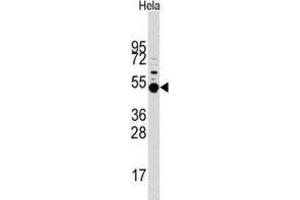 Western Blotting (WB) image for anti-Mitogen-Activated Protein Kinase-Activated Protein Kinase 5 (MAPKAPK5) antibody (ABIN3003051) (MAPKAP Kinase 5 anticorps)