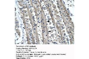 Human Muscle (KIF5B anticorps  (C-Term))
