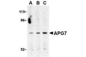 Western blot analysis of ATG7 in Caco-2 cell lysate with ATG7 Antibody at (A) 0. (ATG7 anticorps  (C-Term))