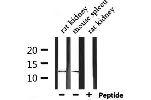 Western blot analysis of extracts from rat kidney and mouse spleen, using IGFL2 Antibody. (IGFL2 anticorps)