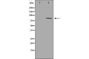 Western blot analysis of B-RAF phosphorylation expression in whole cell lysates,The lane on the left is treated with the antigen-specific peptide.
