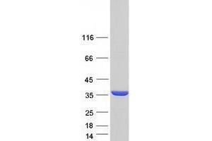 Validation with Western Blot