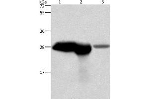 Western Blot analysis of Mouse brain and kidney tissue, Human fetal brain tissue using CALB1 Polyclonal Antibody at dilution of 1:750 (CALB1 anticorps)