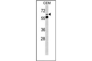 Image no. 2 for anti-FK506 Binding Protein 10, 65 KDa (FKBP10) (AA 65-94), (N-Term) antibody (ABIN453008)