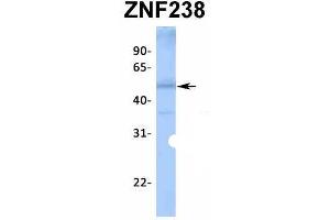 Host:  Rabbit  Target Name:  ZNF238  Sample Type:  Human Fetal Liver  Antibody Dilution:  1.